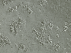 Hepatocytes in Human Plasma, photographed at IVAL Columbia